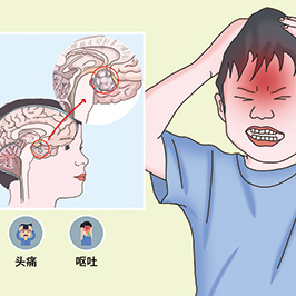 儿童癌症幸存者面临持久的脑膜瘤风险